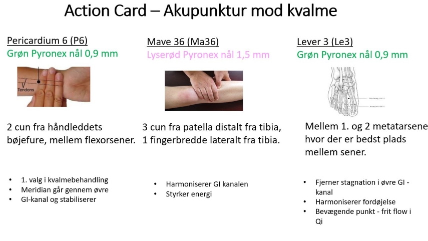 Akupunktur som forebyggelse af kvalme og opkast efter operation